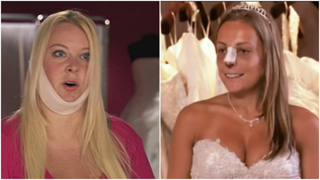 Why Some Women Choose to Have Cosmetic Surgery Before Their Wedding