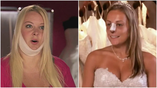 Why Some Women Choose to Have Cosmetic Surgery Before Their Wedding